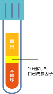 抗炎症性サイトカイン「IL-1Ra」と成長因子の量を増幅