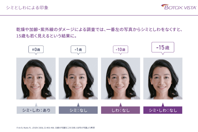 シミとしわによる印象 BOTOX VISTA 乾燥や加齢・紫外線のダメージによる調査では、一番左の写真からシミとしわをなくすと、15歳も若く見えるという結果に。±0 シミ・しわ：あり -1歳 シミ：なし -10歳 しわ：なし -15歳 シミ・しわ：なし Fink B, Matts PJ JEADV 2008;22:493-498. 文献の写真加工を日本人女性の写真より再現